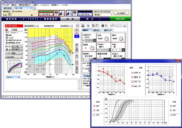 補聴器フィッティングソフト例